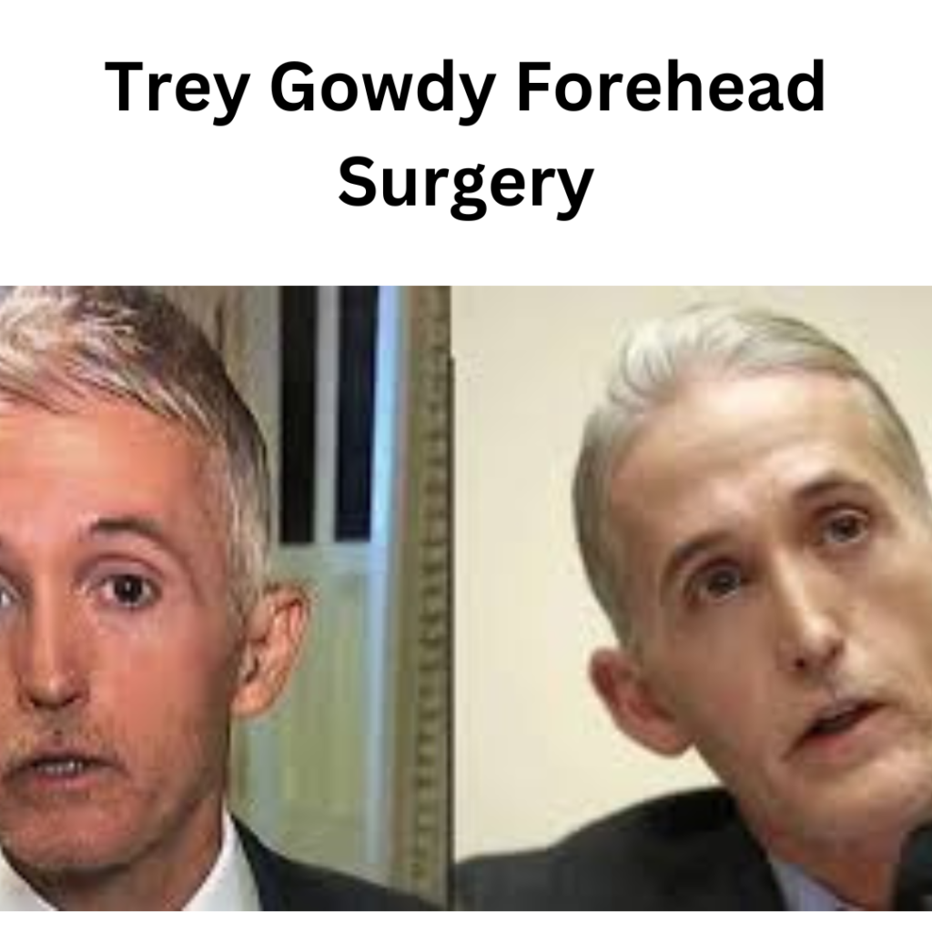 Trey Gowdy Forehead Surgery Unraveling the Rumors and Facts